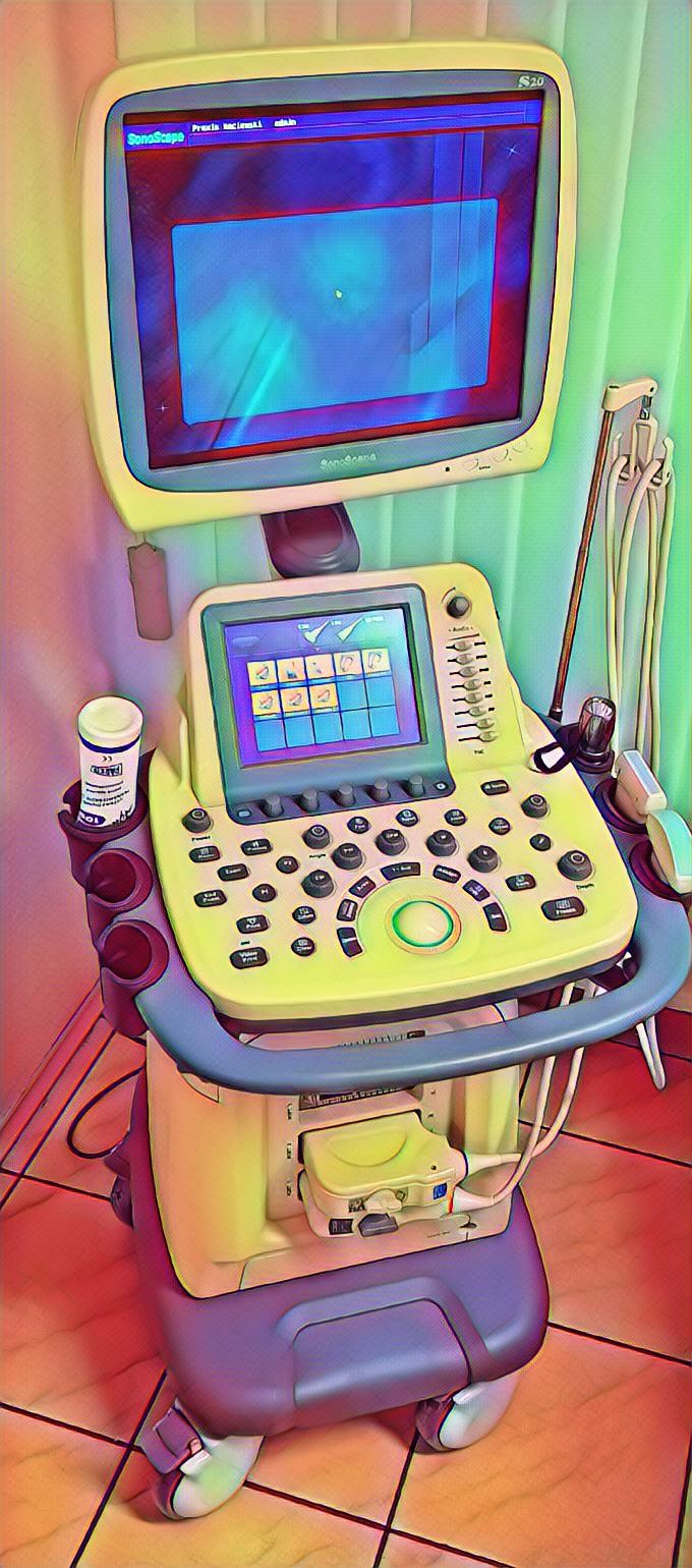 Ultraschallgerät in der Praxis